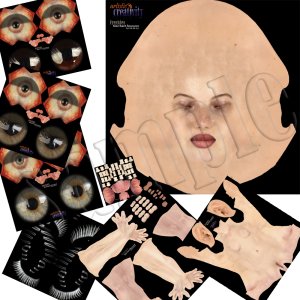  Freckles MR [exc]